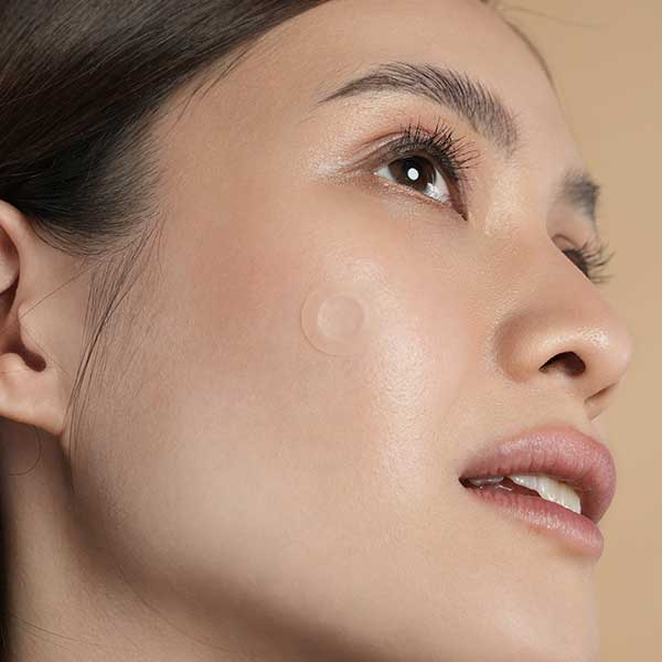 Microneedle - 9 Pack Pimple Patch