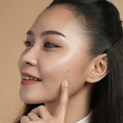 Microneedle - 9 Pack Pimple Patch