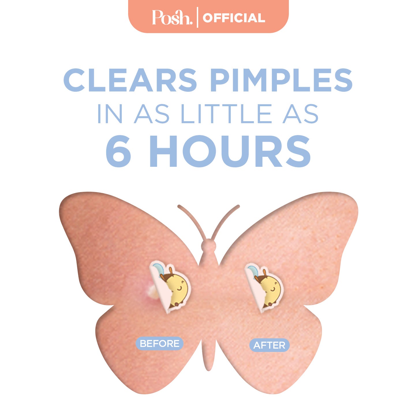 [LIMITED EDITION] Y2K Collection Pimple Patches 32pcs - Hydrocolloid Acne Pimple Patches Tea Tree Oi