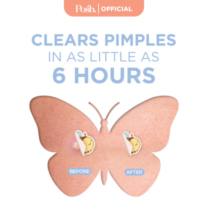 [LIMITED EDITION] Y2K Collection Pimple Patches 32pcs - Hydrocolloid Acne Pimple Patches Tea Tree Oi