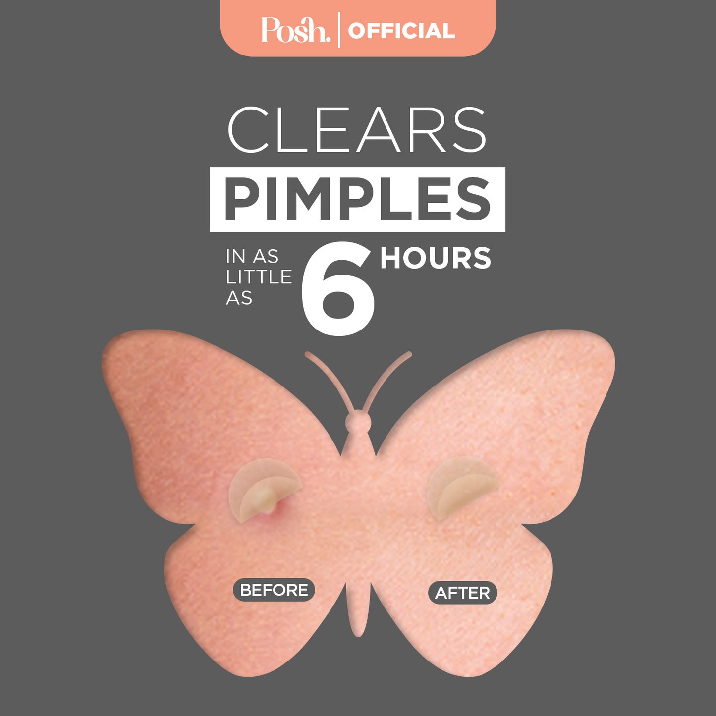 Men's - 48 Pack Pimple Patch
