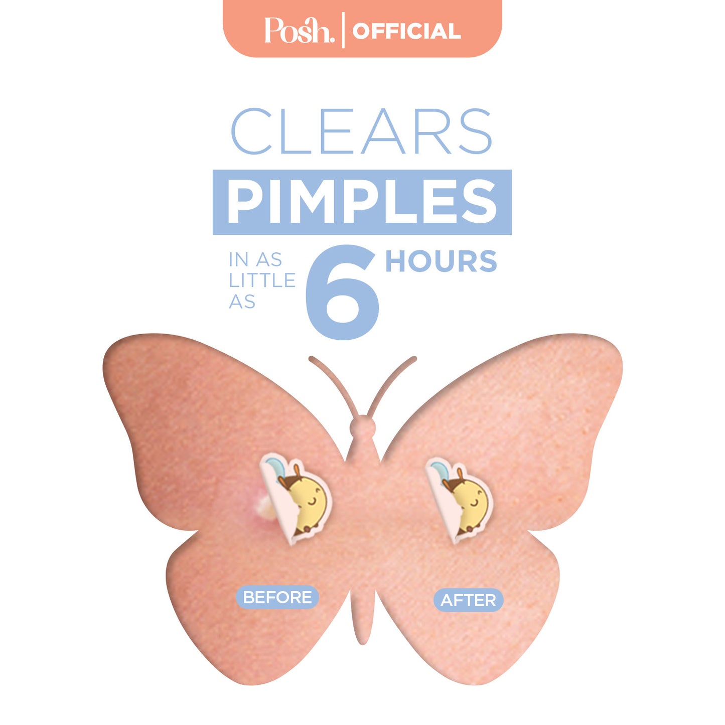 YellowStars - 32 Pack Pimple Patch