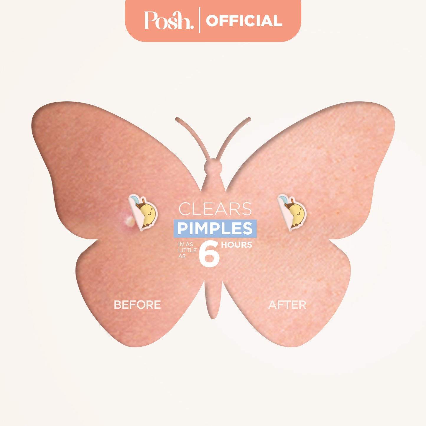 Sport Patches - 48 Pack Pimple Patch